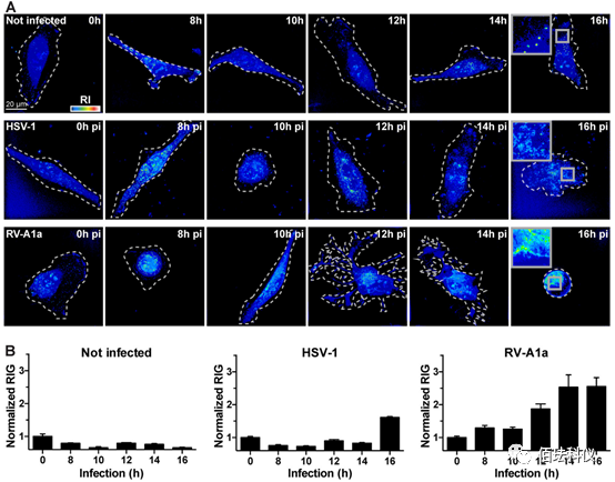 Using Holographic 3D Imaging to Observe Virus-Induced Cytopathic Effects