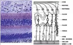 GCC and GCA | Measurement of Ganglion Cell Complex Thickness