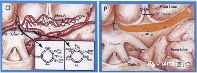 Types of Infarction in Perforating Artery Disease and Advances in Neuroimaging Research