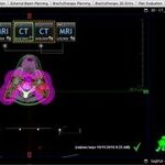 AAPM 263 Standardized Naming for Radiation Therapy Structures