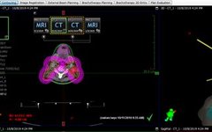 AAPM 263 Standardized Naming for Radiation Therapy Structures