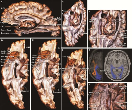 The Anatomical Significance of Brain White Matter Tracts