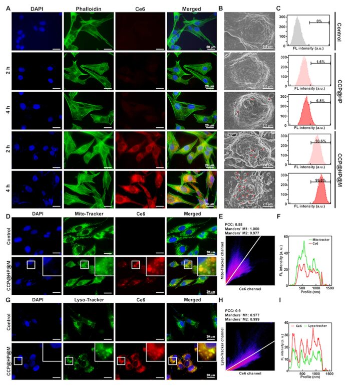 Cascaded Nano-Reactor Enhances Sonodynamic Therapy for Colon Cancer