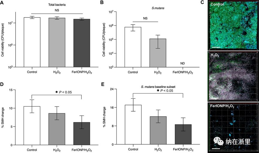 Ferumoxytol Nanoparticles Target Biofilms Causing Tooth Decay