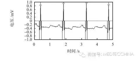 How to Solve the Miniaturization of ECG Monitors