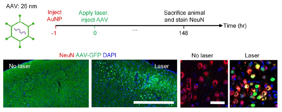 Laser and Gold Nanoparticles: Breaking the Blood-Brain Barrier for Faster Drug Delivery