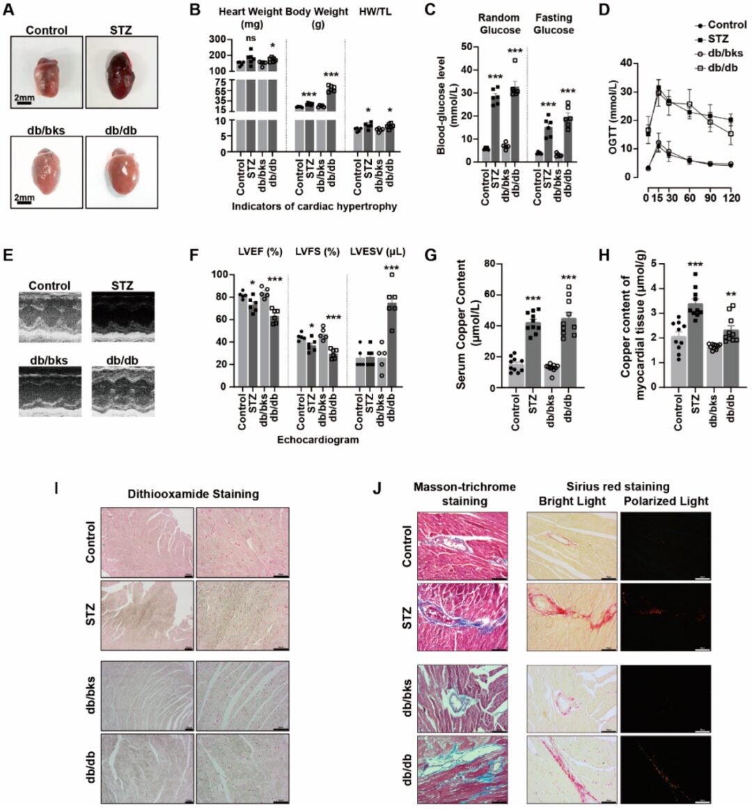 ATF3/SPI1/SLC31A1 Pathway Promotes Copper Death Induced by AGEs in Diabetic Myocardial Injury