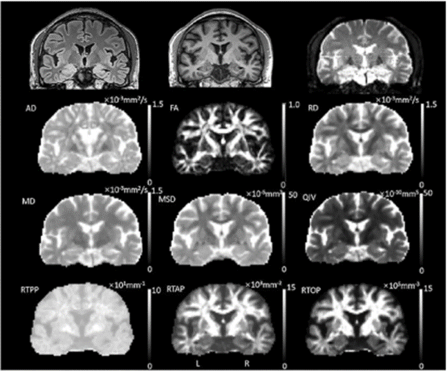 DXI: A Powerful Tool for Clinical Research in Advanced Diffusion Models
