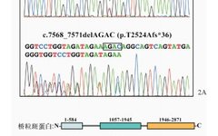 Case Report on Skin Fragility and Woolly Hair Syndrome Due to DSP Gene Mutation