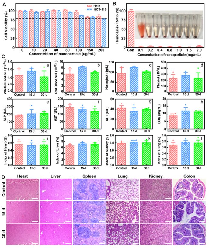 Cascaded Nano-Reactor Enhances Sonodynamic Therapy for Colon Cancer