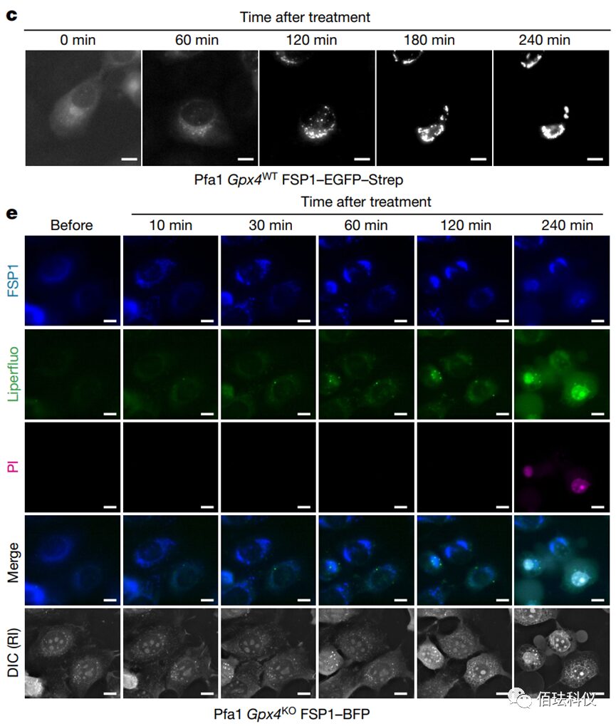 Application of Nanolive in Ferroptosis Research