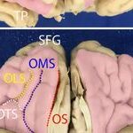 The Anatomical Significance of Brain White Matter Tracts