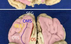 The Anatomical Significance of Brain White Matter Tracts