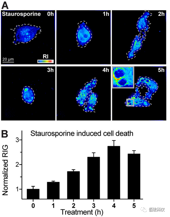 Using Holographic 3D Imaging to Observe Virus-Induced Cytopathic Effects