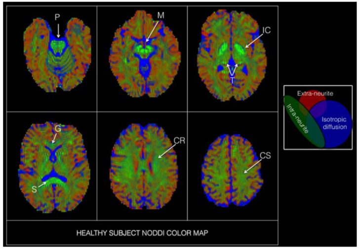 High-Order Diffusion Models in MRI