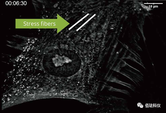Application of Nanolive in Ferroptosis Research
