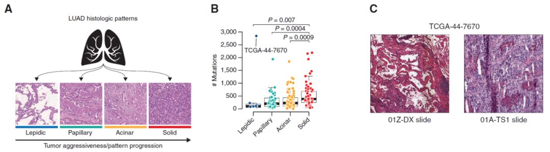 Exploring GeoMx DSP Applications in Cancer Research