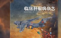 Clinical Practice and Research Progress of Artificial Liver Treatment