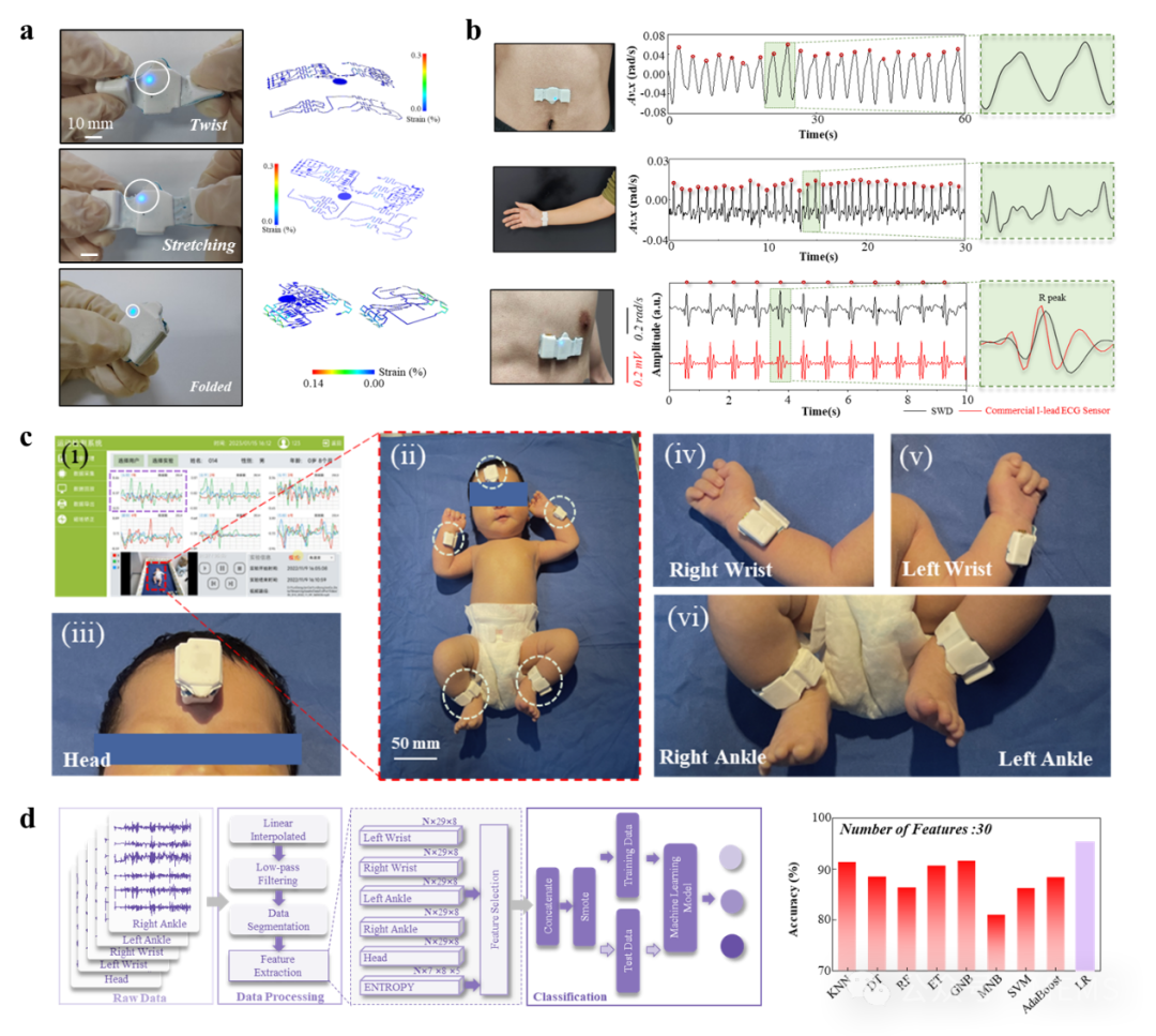 Sparse Sensor Networks for Rapid Screening of Infant Cerebral Palsy