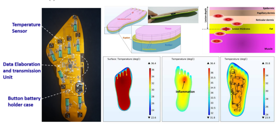 Current Research Status of Diabetic Foot Protection Techniques and Foot Aids