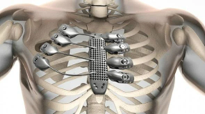 3D Printing Craftsmanship and Innovation
