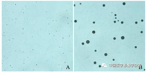Inhibition of Breast Cancer Cells by Novel Nanoparticles Combined with Low-Intensity Focused Ultrasound