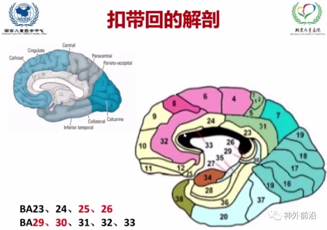 Cingulate Cortex Epilepsy and Surgical Treatment
