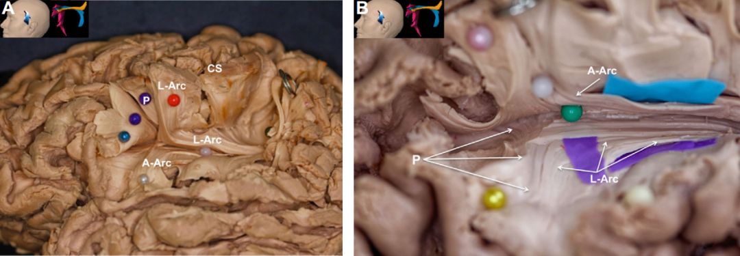 The Anatomical Significance of Brain White Matter Tracts