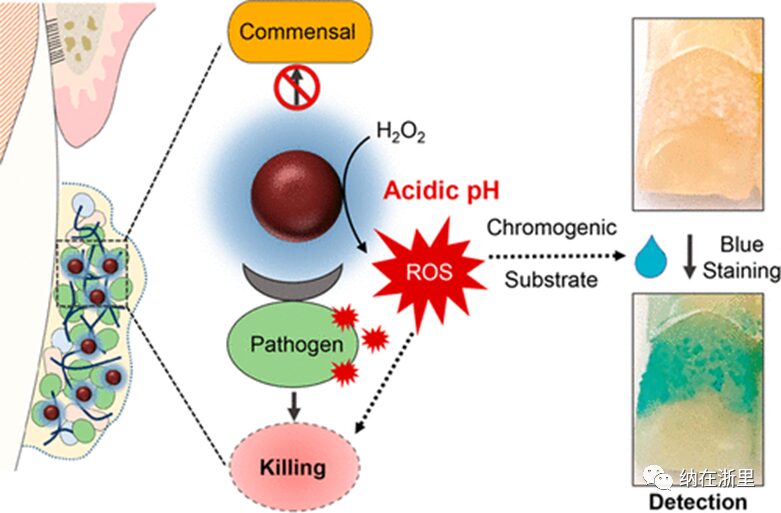 Ferumoxytol Nanoparticles Target Biofilms Causing Tooth Decay