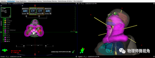 AAPM 263 Standardized Naming for Radiation Therapy Structures