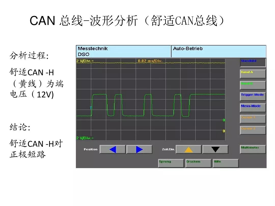 Detailed Explanation of Automotive CAN Bus