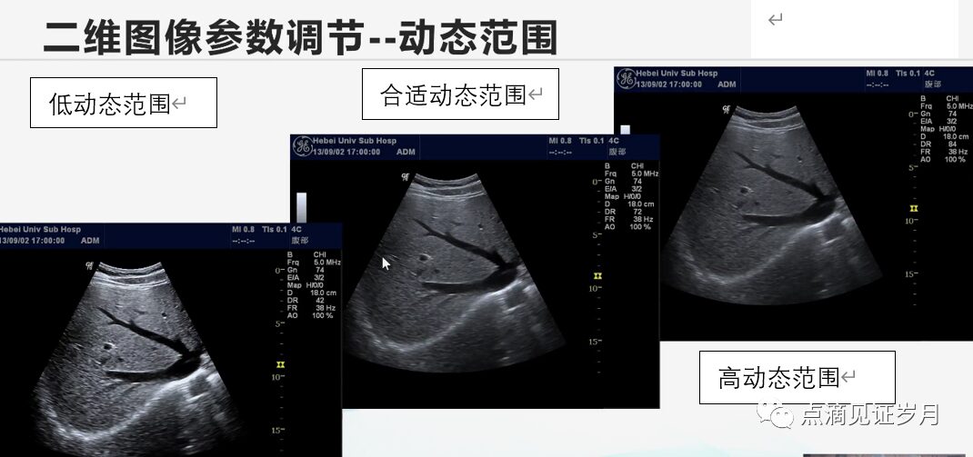 Understanding and Adjusting Parameters of Color Doppler Ultrasound Machines