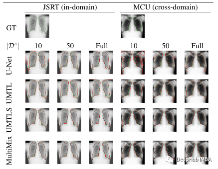 Multimix: Semi-Supervised, Explainable Multi-Task Learning from Medical Images