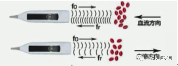 Understanding and Adjusting Parameters of Color Doppler Ultrasound Machines