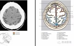 The Most Comprehensive CT Cross-Sectional Anatomy Atlas