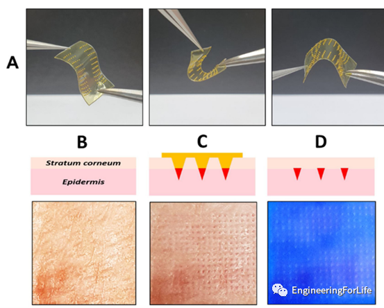 Applications of Projection Photopolymerization in 3D Bioprinting: Microneedles, Microspheres, and Microfluidic Chips