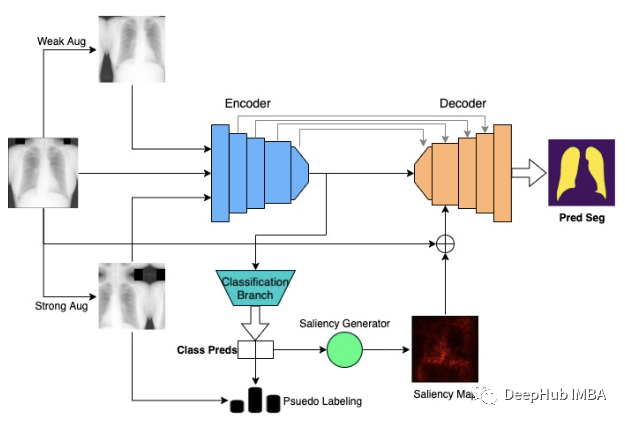 Multimix: Semi-Supervised, Explainable Multi-Task Learning from Medical Images