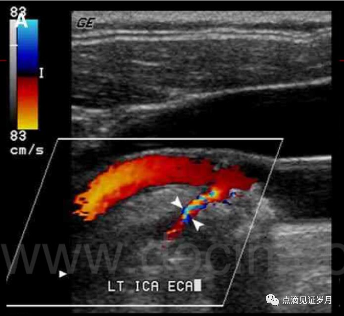 Understanding and Adjusting Parameters of Color Doppler Ultrasound Machines