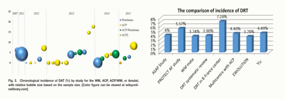 Left Atrial Appendage Closure: DRT Detection and Management