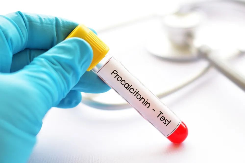 Detailed Interpretation of Common Infection Markers: CRP, PCT, and More