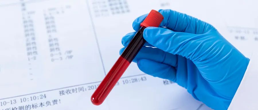 What To Do If Your High-Sensitivity C-Reactive Protein Is Elevated?