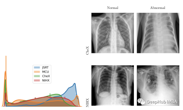 Multimix: Semi-Supervised, Explainable Multi-Task Learning from Medical Images