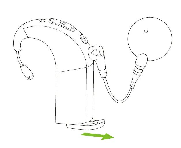 Comprehensive Analysis of Naida CI Connect Wireless Listening Accessories