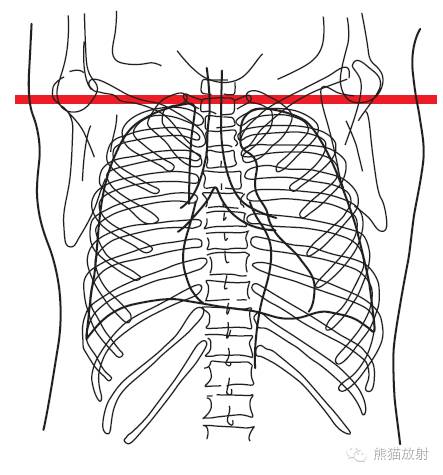 Chest Anatomy | Chest CT Cross-Sectional Anatomy