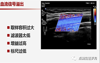 Understanding and Adjusting Parameters of Color Doppler Ultrasound Machines