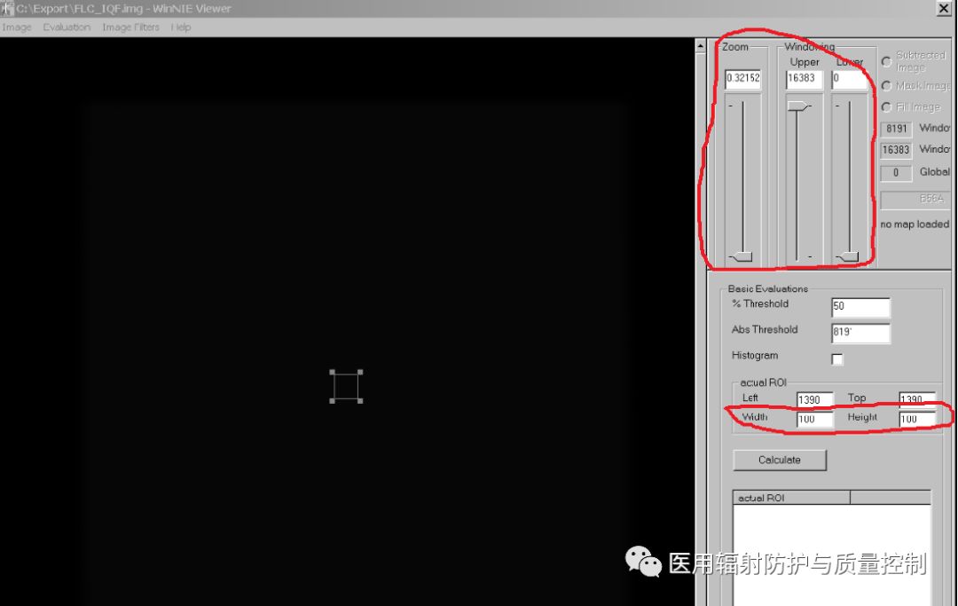 Siemens DR Preprocessing Image Retrieval (Part 1)