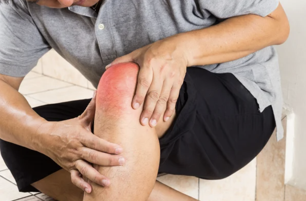 DIY Gout Treatment: Doctor Explains Patient Mistakes