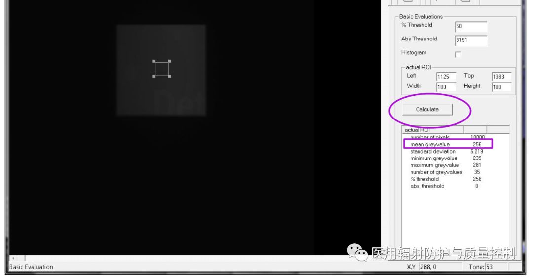Siemens DR Preprocessing Image Retrieval (Part 1)