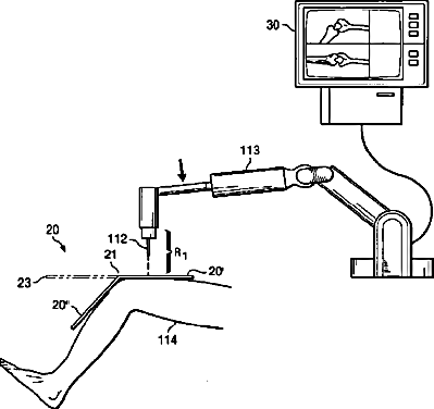 In-Depth Analysis of Surgical Robot Patents (Mako)