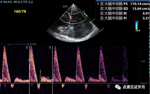 Understanding and Adjusting Parameters of Color Doppler Ultrasound Machines